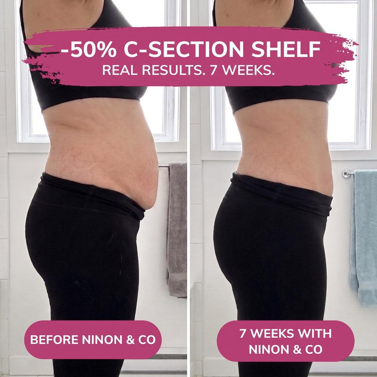 Ninon & Co 360° postpartum compression briefs
