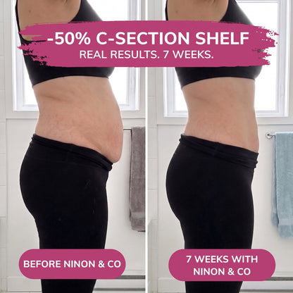Ninon & Co 360° postpartum compression briefs